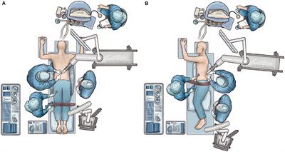 Robotics in Spine Surgery: A Technical Overview and Review of Key Concepts